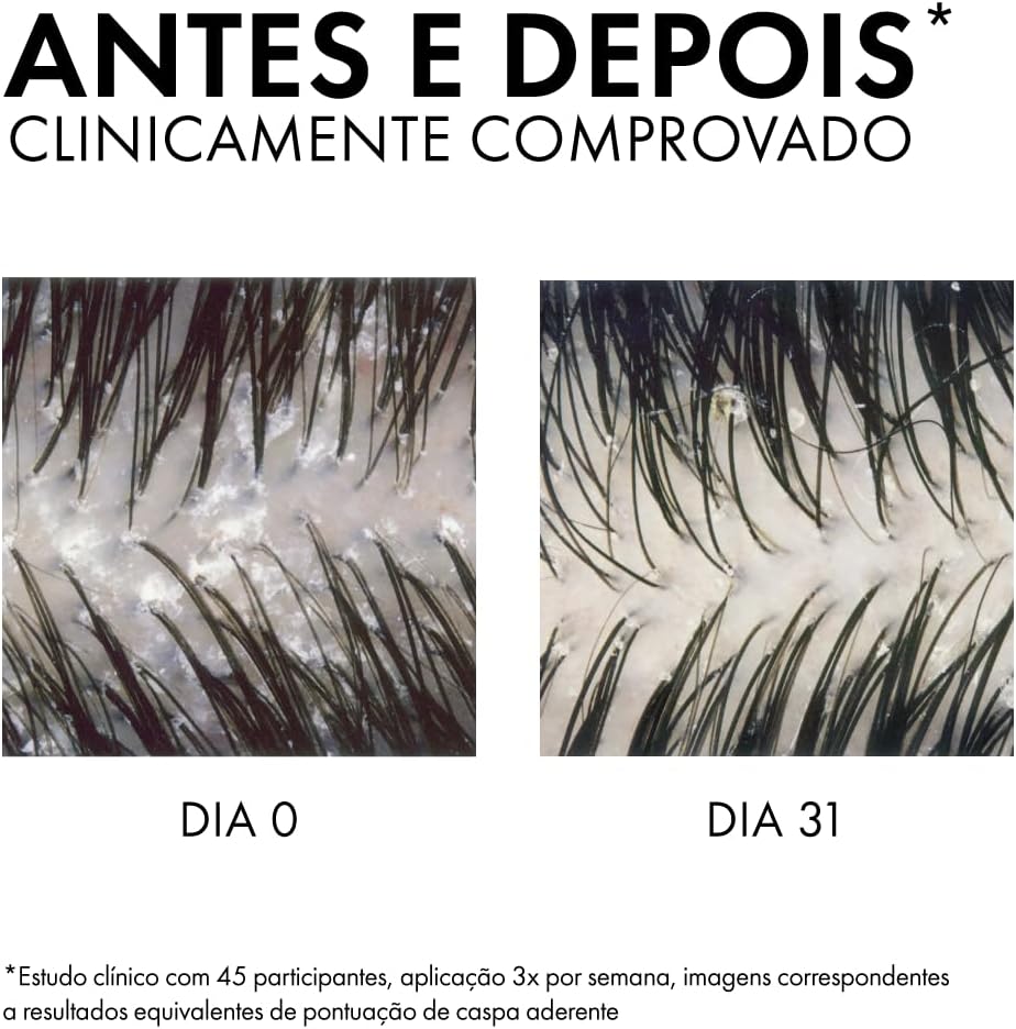 Vichy, Dercos Shampoo Anticaspa para Cabelos Normais a Oleosos - Imagem 13
