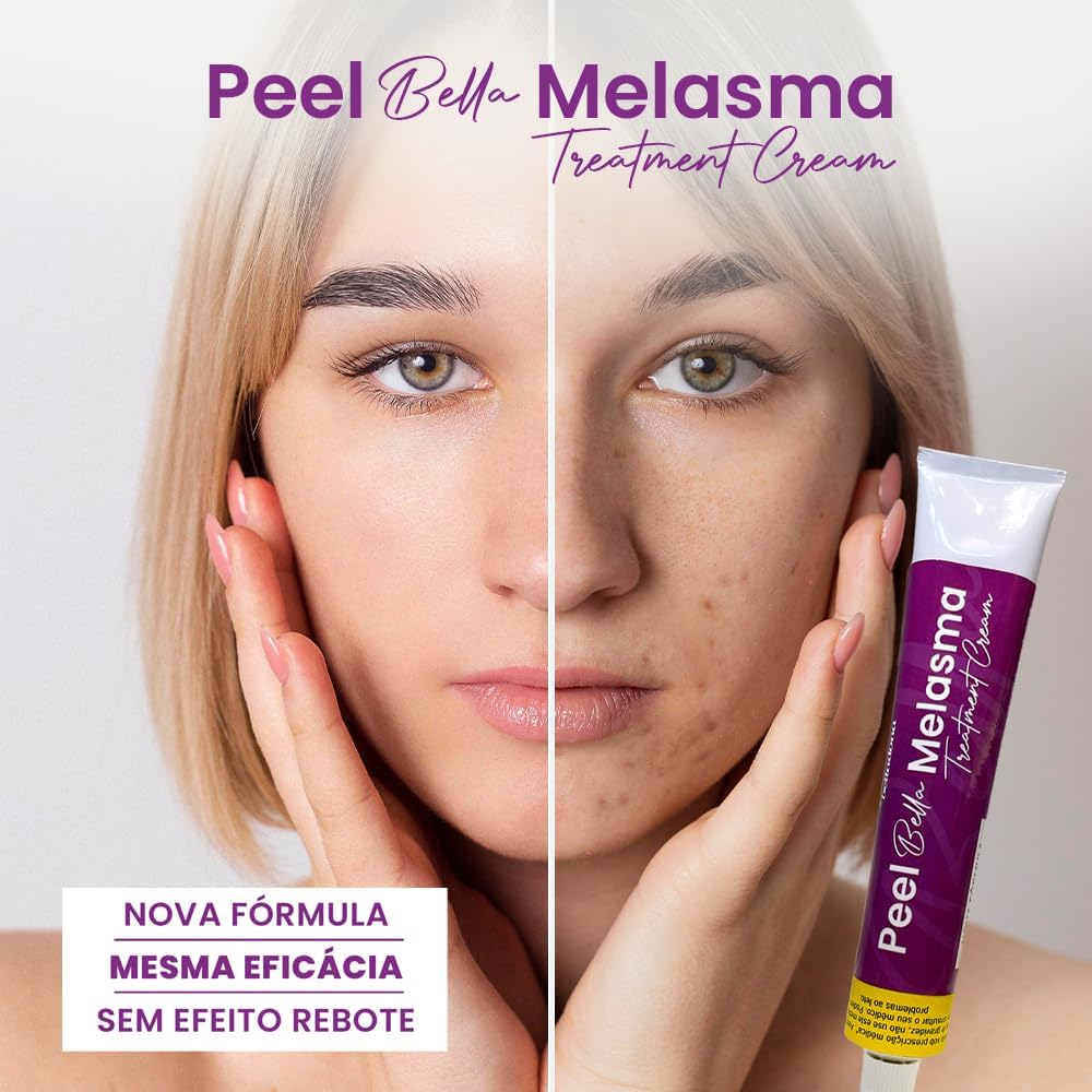 PeelBella - Melasma Treatment Cream - 30g - Belladona - Imagem 7