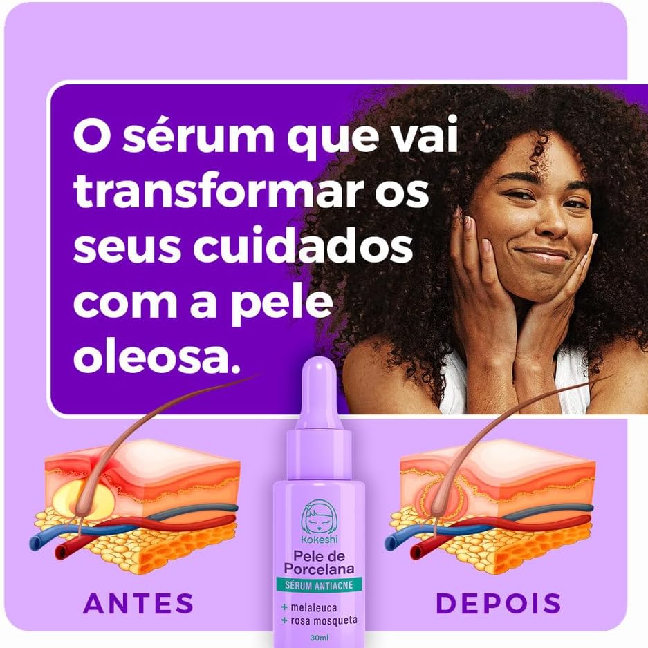 Sérum Facial Antiacne Pele de Porcelana Kokeshi 30ml - Imagem 5